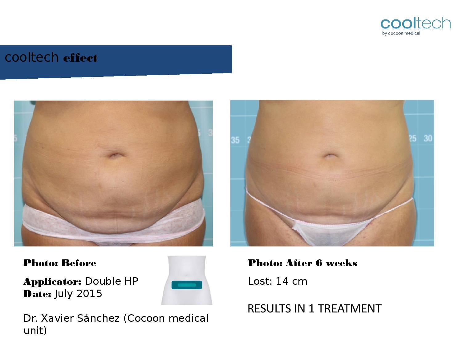 Presentation Cooltech ENG Wigmore Days Novaaaa1-page-008